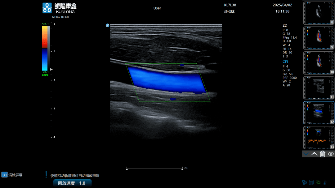 安徽鲲隆康鑫医疗科技有限公司